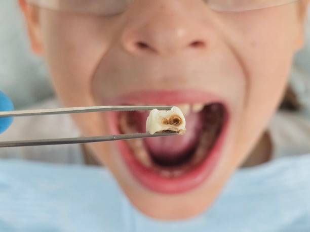 Best Cracked Tooth Emergency Dentist  in Mustang, OK